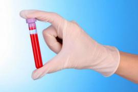 Syphilis Testing - Why It Is Important to Test for Syphilis