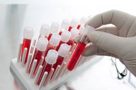 Determination of disease by a blood test