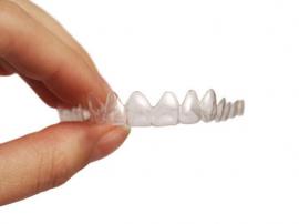Which is Better - Traditional Metal Braces or Invisalign Braces Tampa?