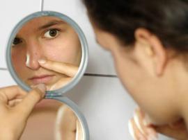 Acne Care and Solutions