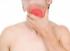 Scratchy throat: find out the cause and begin treatment photo