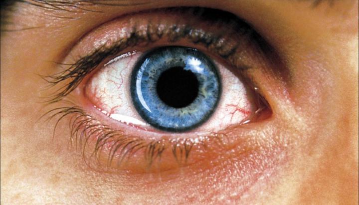 Combined pharmacotherapy of Uveitis