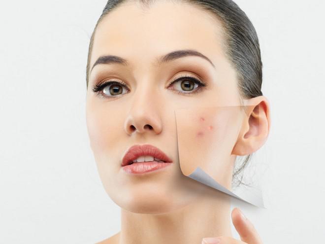 The Best Sources for Acne Scar Removal Products