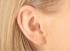 Otoplasty Affordable Ear Correction photo