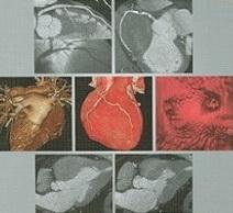 Cardiothoracic Surgery